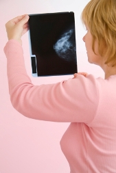 breast cancer